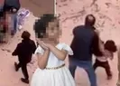 Pitbull saldırısı olayında yeni gelişme