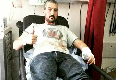 Vatan uğruna 6 yıldır şarapnel parçalarıyla yaşıyor! 15 Temmuz'da yaşadıklarını anlattı - 3