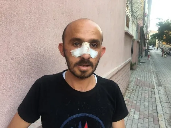 Ümit Özdağ’ın Suriyeli provokasyonu elinde patladı! Gaziantep Valisi gerçekleri açıkladı! İçişleri’nden sert tepki: Yatacak yerin yok