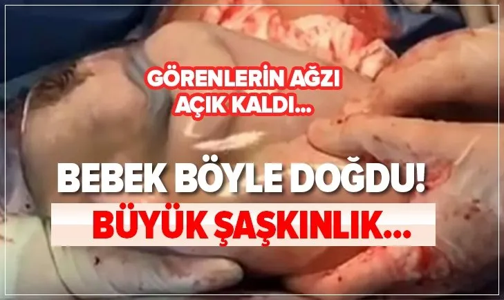 Bebek bu halde doğdu! Görenlerin ağzı açık kaldı...