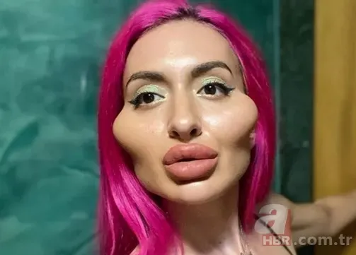 Fatih’te estetik yaptıran Bulgar modelin hayatı kabusa döndü! ‘Örümcek ağı’ operasyonu bakın ne hale getirdi? 19