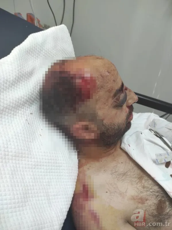 Bursa'da dehşete düşüren olay! Önce otomobille çarptılar sonra öldüresiye dövdüler