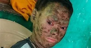 ’Yılan Kız’ın son hali görenleri şaşırttı