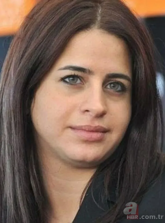 Büşra Pekin’de estetikle yeni birine dönüşenler kervanında! 1 estetiğim var deyince ti’ye alınmıştı… 4 bantla o hale gelmiş! 6