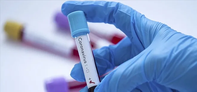 Kan grubu "0" olanlara flaş korona virüs uyarısı! Uzman isim açıkladı