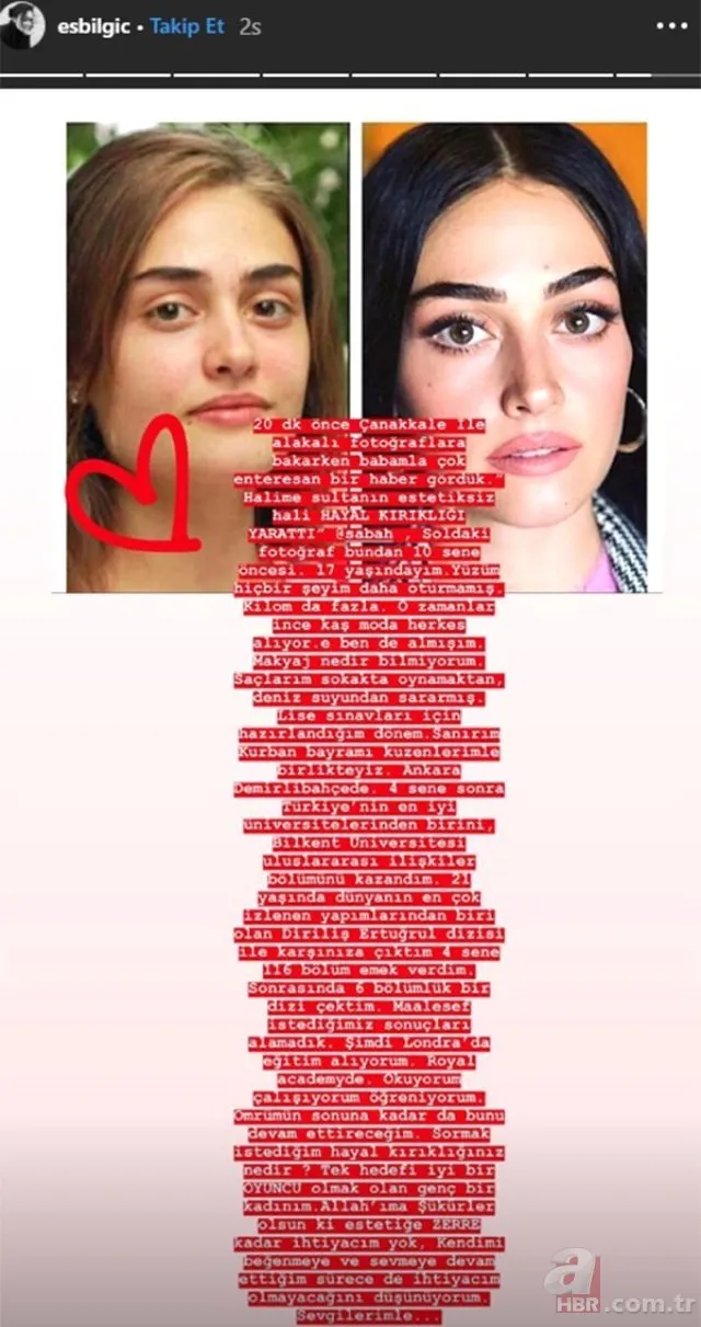 Ramo dizisinin Sibel�i Esra Bilgiç�in yıllar önceki fotoğrafı ortaya
