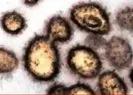Koronavirüsün Coronavirus en net görüntüleri ortaya çıktı |Video