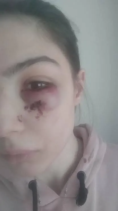 esini-sokak-ortasinda-bicakladi-mahkeme-tahrik-indirimini-kabul-etmedi-1639735995237.jpg Eşini sokak ortasında bıçakladı! Mahkeme tahrik indirimini kabul etmedi - 1