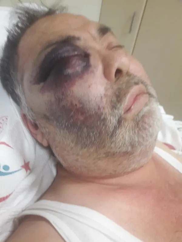 1614512821354.jpg Antalya'daki vahşetten acı haber! Mümin Kara hayatını kaybetti! - 1