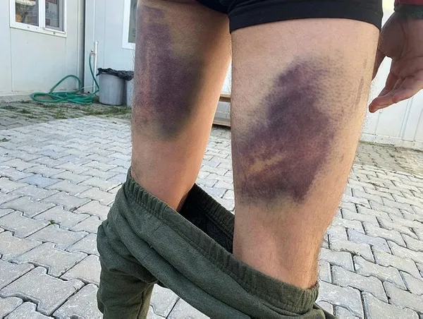 Yunan zulmünden Türk jandarması kurtardı! Mehmetçik olmasaydı 40’ımız da donacaktık