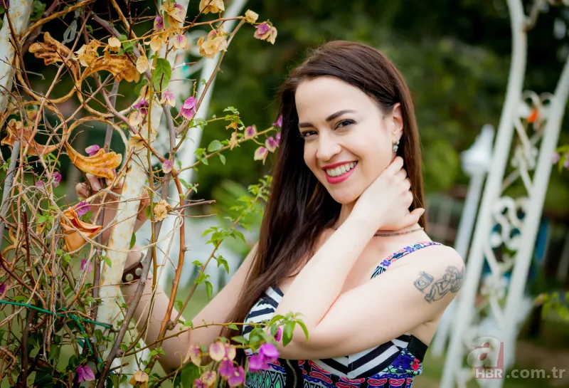 Şarkıcı ve oyuncu Zeynep Doruk dehşeti yaşadı! Köpekler saldırdı: Yüzü tanınmaz hale geldi 4