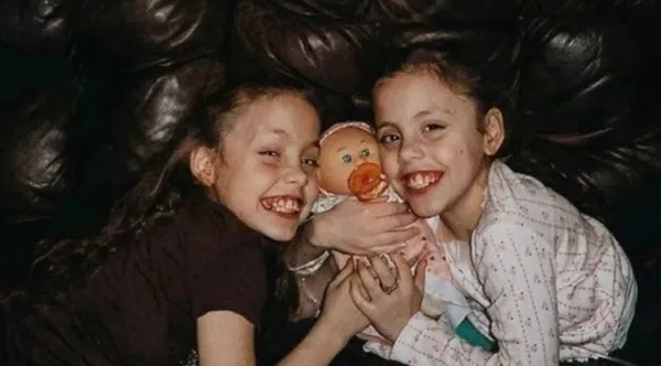 Kaybettiği yapışık ikizinin hayalini gerçekleştirdi! Hikayeleri Yürek bukrtu