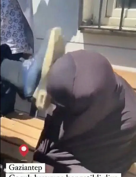 Gaziantep'te 70 yaşındaki Suriyeli kadına tekme atan şüpheliden akılalmaz savunma! Leyla Muhammed'in sağlık durumu nasıl? - 1