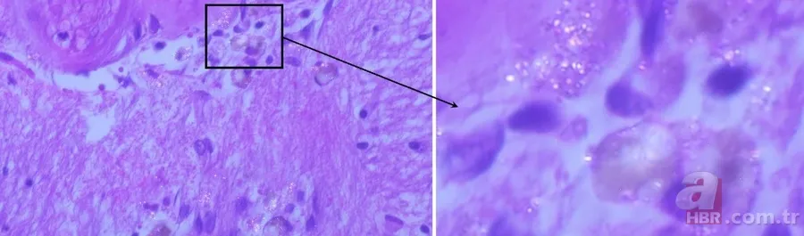 İnsan beynini bekleyen büyük tehlike! Plastikle doluyor... 5