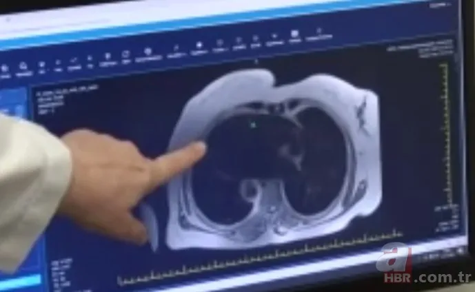 İnanılmaz! Doktorları bile hayrete düşürdü: 66 yıldır iç organları tersine çalışıyor 7