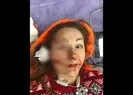 Eşinin yüzünü falçata ile bu hale getirdi