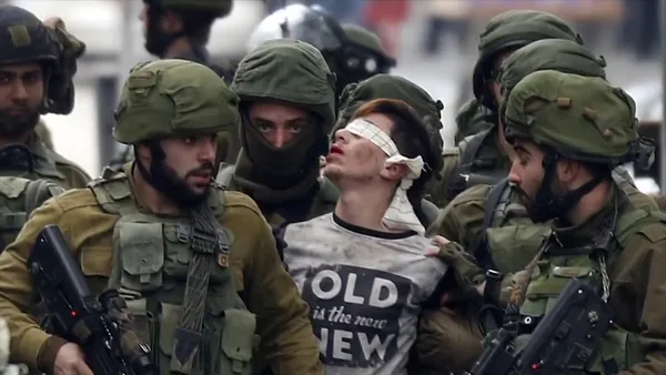 İsrail’de zulüm üstüne zulüm! Filistinli gencin yüzüne metal bir alet ile Davud Yıldızı kazıdılar