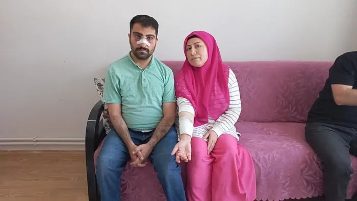 engelli-komsusunun-burnunu-kirdi-ardindan-sicak-su-doktu-1713725125859.jpeg Amasya'da akılalmaz olay! Engelli komşusunun burnunu kırdı: Yetmedi ardından sıcak su döktü - 3