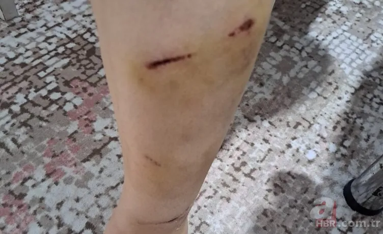 Ekrem İmamoğlu'nun danışmanı Murat Ongun'dan ısıran köpeğine koruma şikayetçi çalışana tehdit! Hem sahip çıkmadı hem işten kovdurdu 11