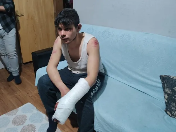 1615285490696.jpg İki yüz lira alacağı olan 16 yaşındaki gence 5 saat işkence - 3