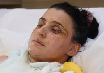 Jel yakıt hastanelik etti!