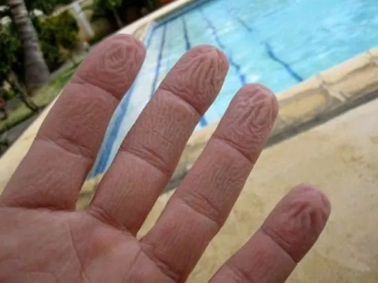 Parmakların suda buruşmasının gerçek nedeni