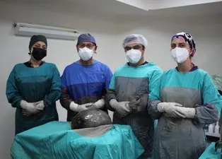 Eskişehir'de gaz şikayetiyle doktora gitti karnından tam 9 kilo çıktı! Türk doktorlar hayrete düştü