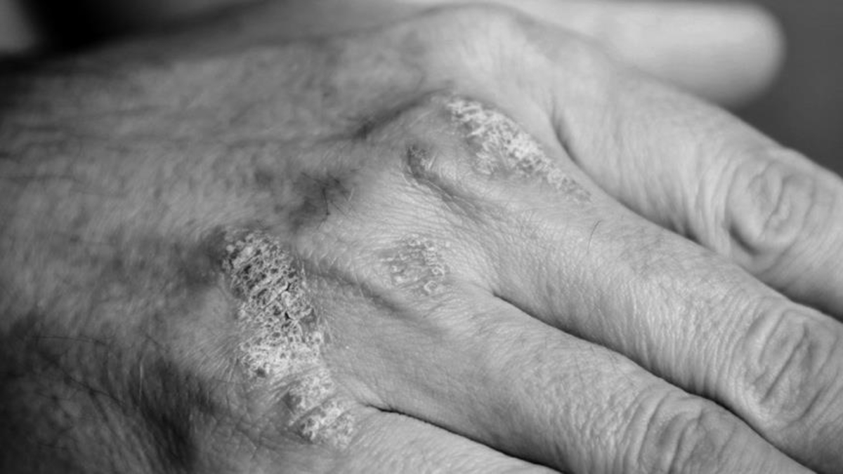 Doğrudan cilde temas eden kumaşlara dikkat edin