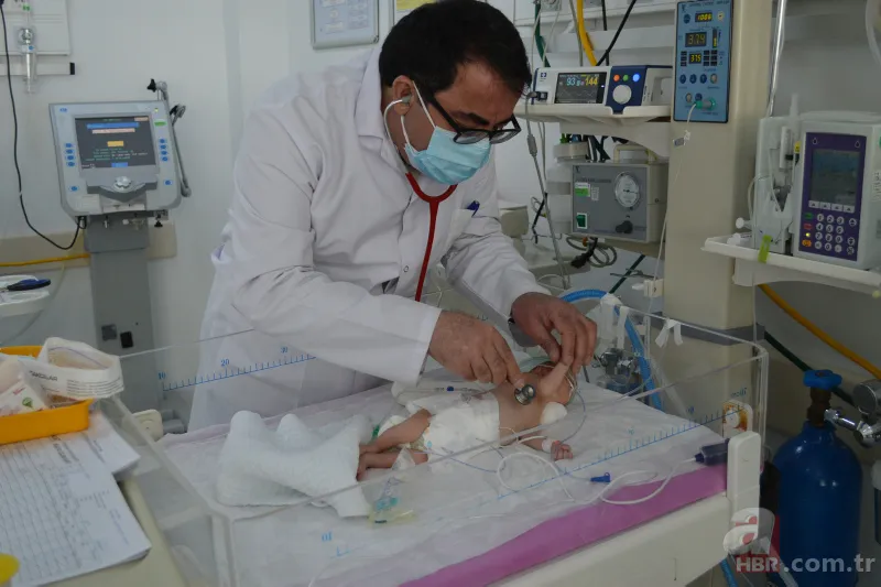 40 binde bir görülüyor! Kilosu kadar tümörle dünyaya geldi | Dünyanın en ilginç hastalıkları 2