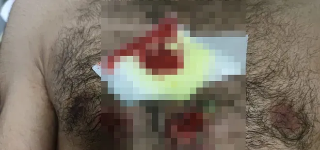 Yunanistan’dan insanlık dışı muamele! Göçmenlere karşı plastik mermi