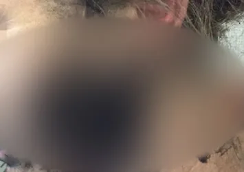 Uçakta kulaklık alev aldı, yolcu hafif yaralandı