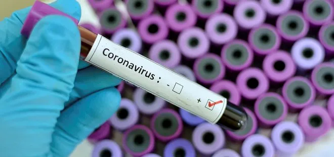 Son dakika: İran’da 2 kişi koronavirüsü nedeniyle hayatını kaybetti