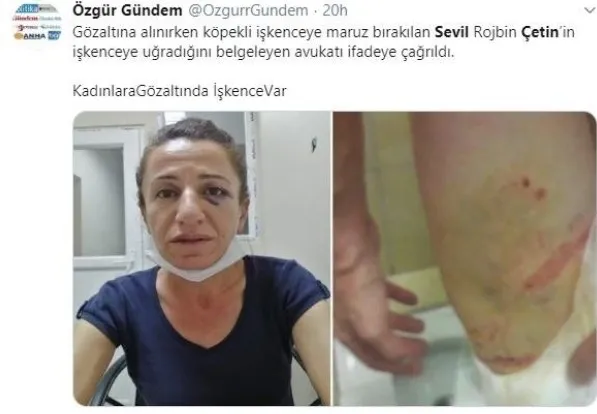Diyarbakır Valiliği köpekle işkence iddiasını yalanladı