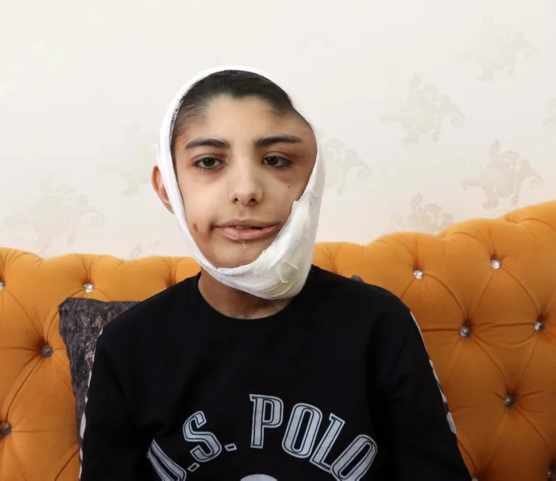 Çenesinin altına kadar indi! Yüzündeki yara her geçen gün büyüyor