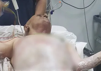 Sigara yüzünden bu hale geldi