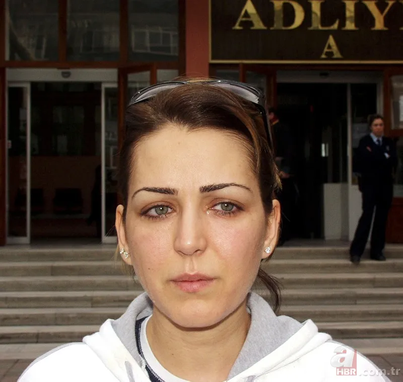 Pınar Dilşeker görenleri şoke etti! Yaptırdığı estetiklerle öyle bir hale geldi ki tanımak imkansız 6