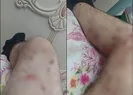 Kavga ayırmaya gitti tüfekle vuruldu