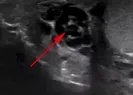 Doktor ultrason ekranına bakınca şaşkına döndü!