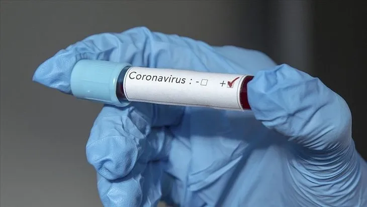 Corona belirtileri gün gün böyle ortaya çıkıyor! Koronavirüs belirtileri semptomları neler?