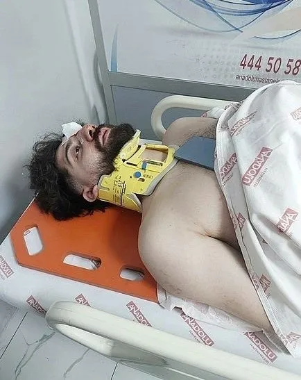 Canbay Wolker sağlık durumu nasıl? Canbay Wolker kaza mı geçirdi?