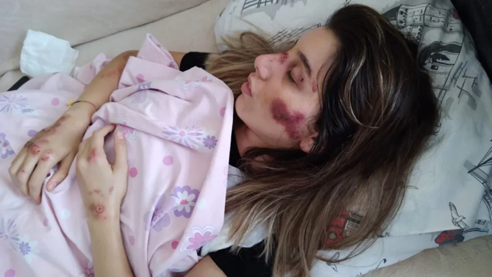 Adana’da feci kaza! "Kızım yataktan kalkamıyor"
