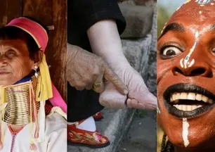 O ülkelerde güzelliğin bedeli ağır: İşte tarihe geçen sıra dışı uygulamalar