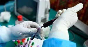 Dikkat öldürücü! Nezleye benziyor sakın hafife almayın