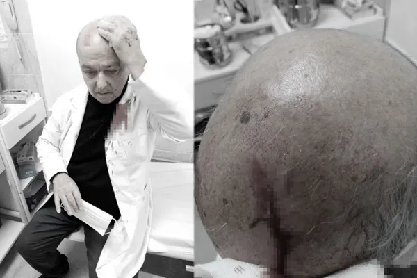 İzmir maganda dehşeti! Maske uyarısı yapan doktorun kafasını taşla yardı - 4