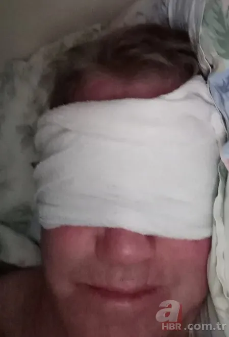 3 senedir gözlerini kapatamıyor! Sağlığına kavuşmak için Türkiye’ye geldi 5