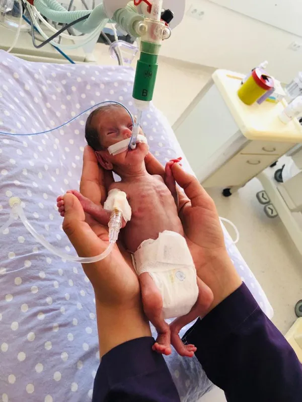 1610101032698.jpg 520 gramdan 410'a düşmüştü! Nisa bebek tam 142 gün sonra taburcu edildi - 1