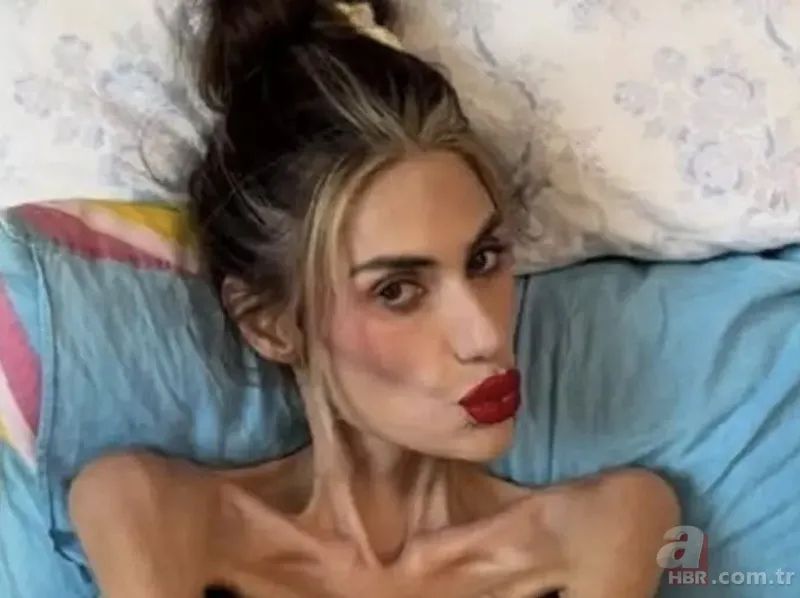 Anoreksiyadan hayatını kaybeden Nihal Candan'ın acılı babası konuştu: Şöhret dünyasına girince sapıttı 1