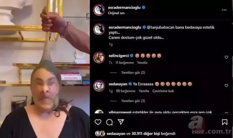 Esra Dermancıoğlu estetikli ünlüleri ti’ye aldı! Seda Sayan sessiz kalamadı 4