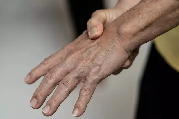 ellerinizde-uyusma-yanma-karincalanma-kulak-cinlamasi-gibi-belirtilerle-ortaya-cikiyor-muhtemelen-o-vitamin-ek-1700850666305.jpeg Ellerinizde uyuşma, yanma, karıncalanma, kulak çınlaması gibi belirtilerle ortaya çıkıyor! Muhtemelen o vitamin eksik! İşte tamamlayabileceğiniz besinler… - 8