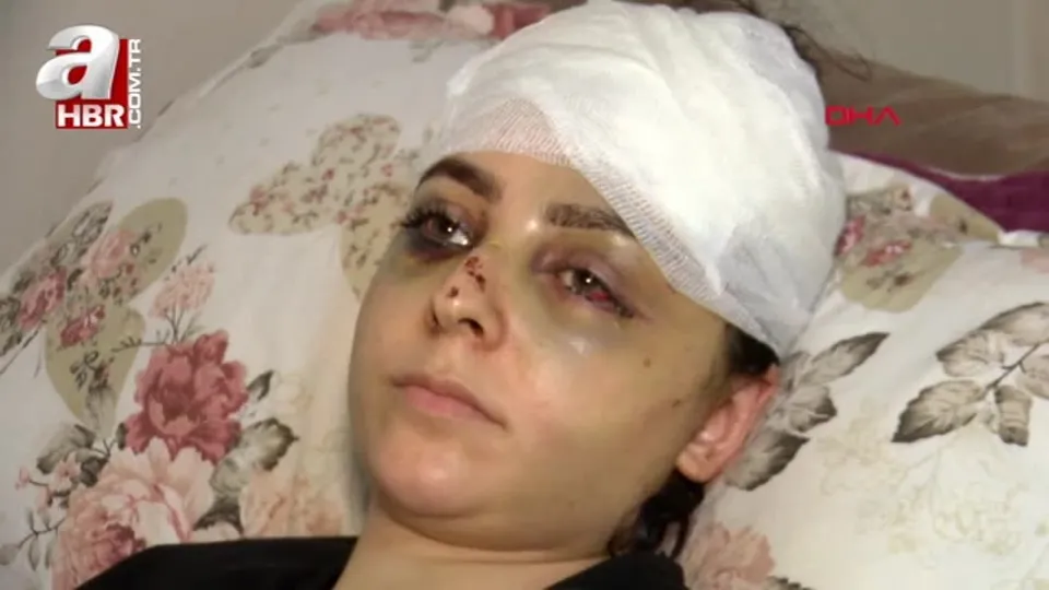 Neden tayt giydin dayağı hastanelik etti!